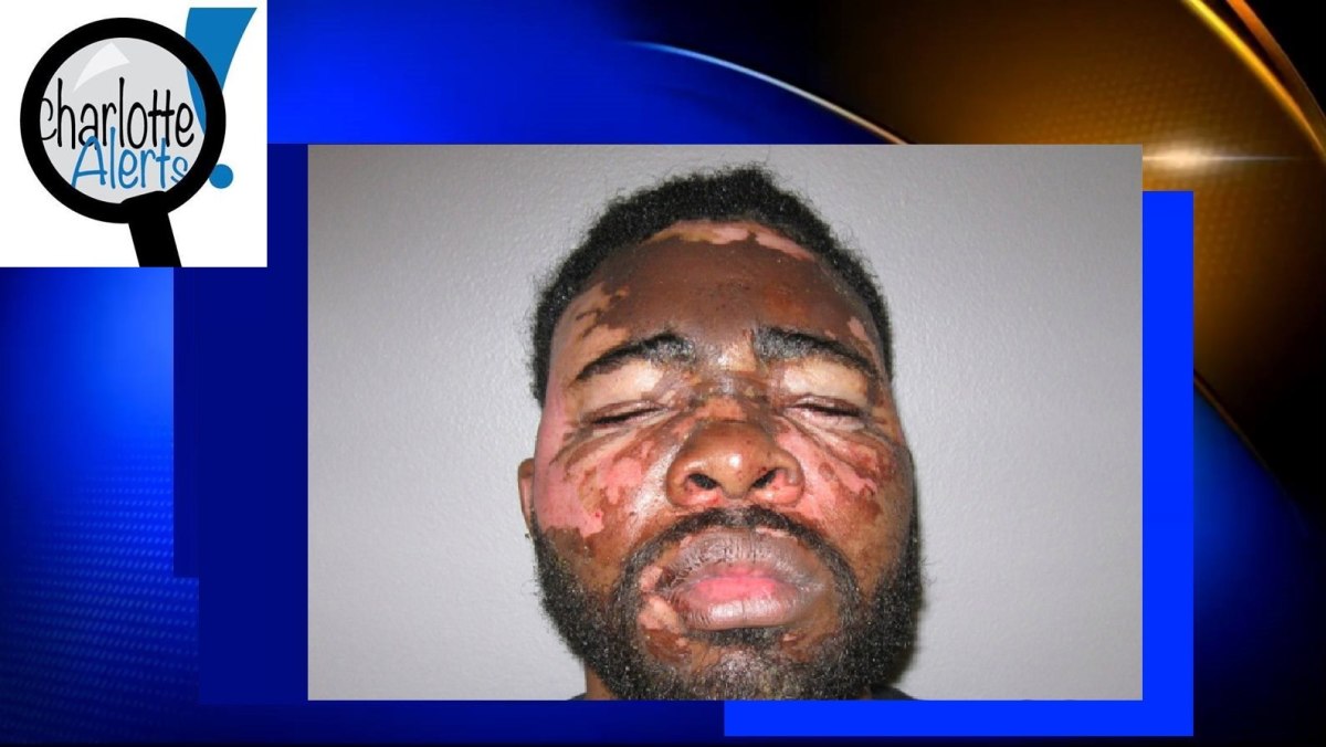 Click here to see when an Alabama woman threw hot grease on her ex-boyfriend Larondrick Macklin