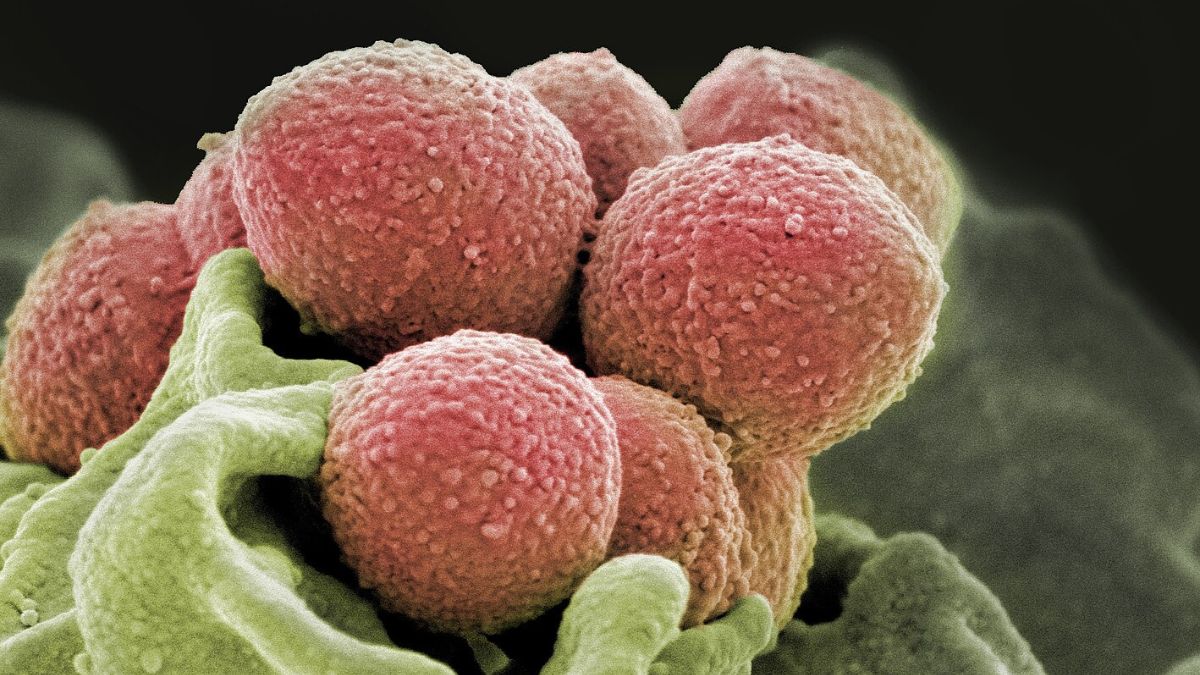 Infections linked to a fatal "eaten" bacteria explode in the United States