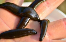 A leech discovered in a patient’s nostril after twenty days of worrying symptoms