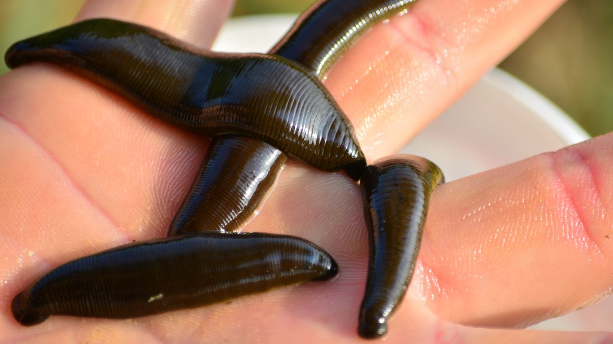A leech discovered in a patient's nostril after twenty days of worrying symptoms