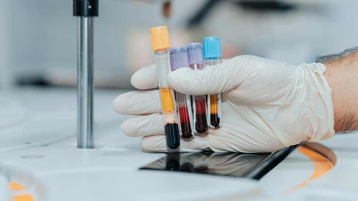 A blood test could detect more than fifty types of cancer, a revolution for medicine