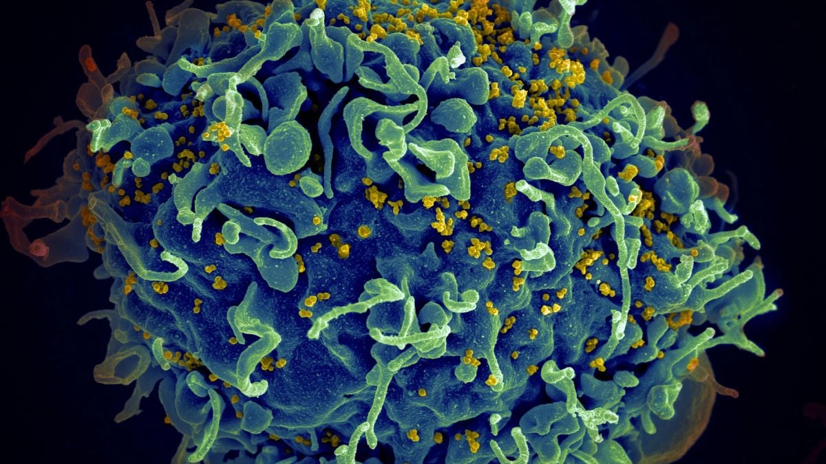 Revolutionary treatment can end HIV, but political and economic blockages remain