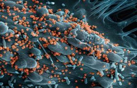 This mysterious virus that appeared in Africa kills in 80% of cases