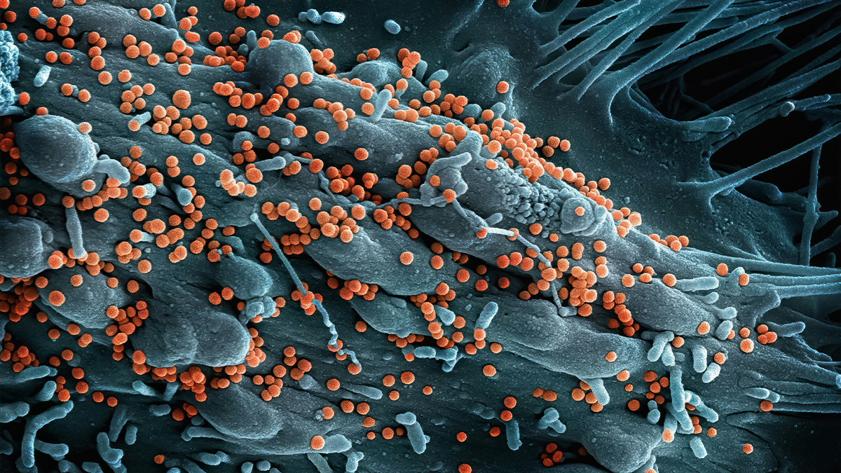 This mysterious virus that appeared in Africa kills in 80% of cases