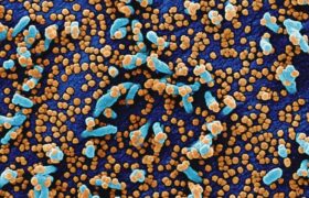 What do you think of super bacteria resistant to antibiotics? Global warming takes care of it