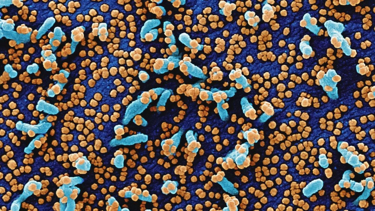 What do you think of super bacteria resistant to antibiotics? Global warming takes care of it