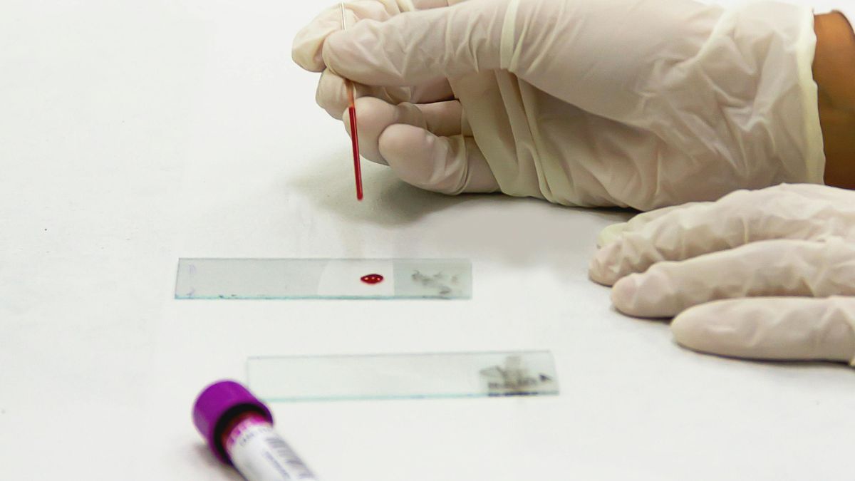 What if menstrual blood analysis finally made it possible to diagnose endometriosis earlier?
