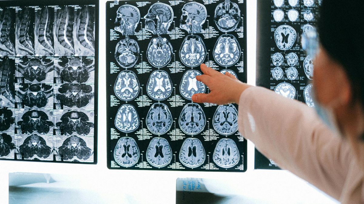 The number of hard-to-diagnose “invisible” cancers has exploded in recent years