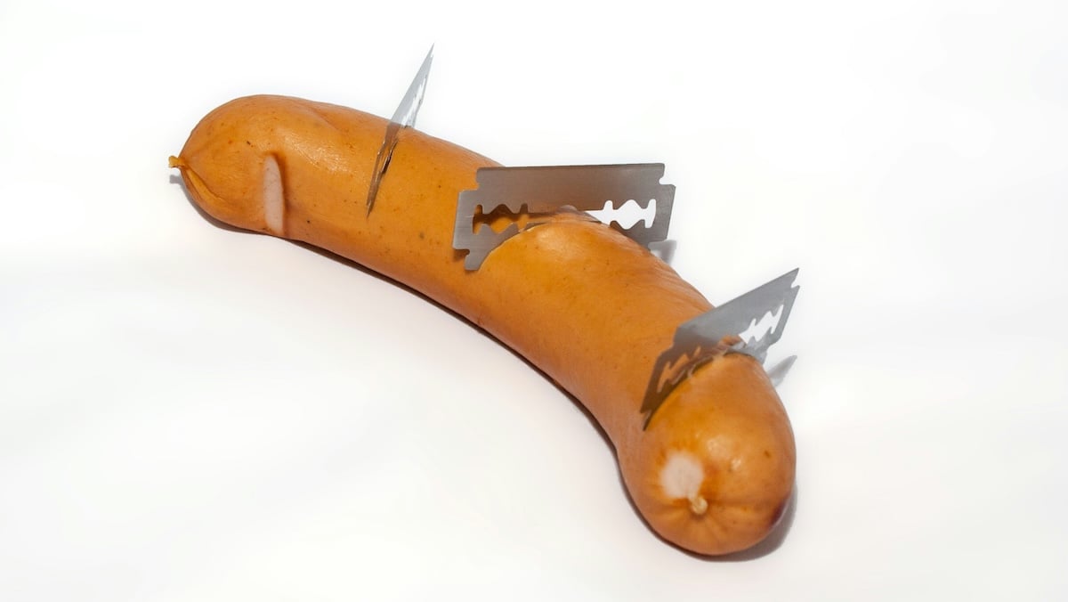 A start-up wants to regrow foreskins from corpse tissue, everyone has their own ideas