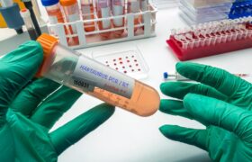Hantavirus transmission: authorities would do better to admit their ignorance