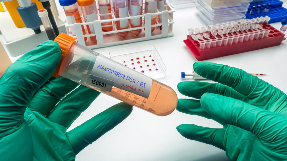 Hantavirus transmission: authorities would do better to admit their ignorance